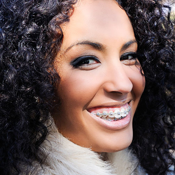 Korne Ortho Adult Treatment Orthodontist in Montreal